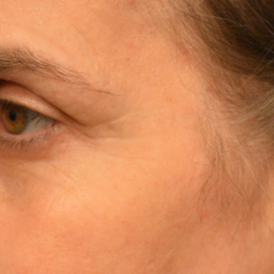 Eye Love It®, after