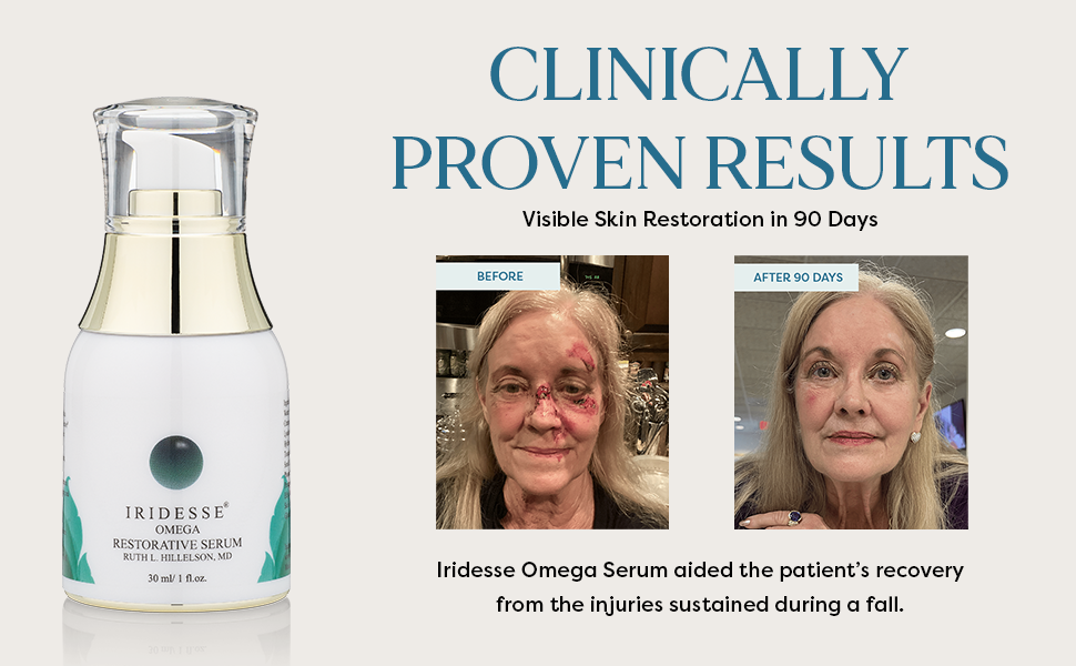 OMEGA RESTORATIVE SERUM