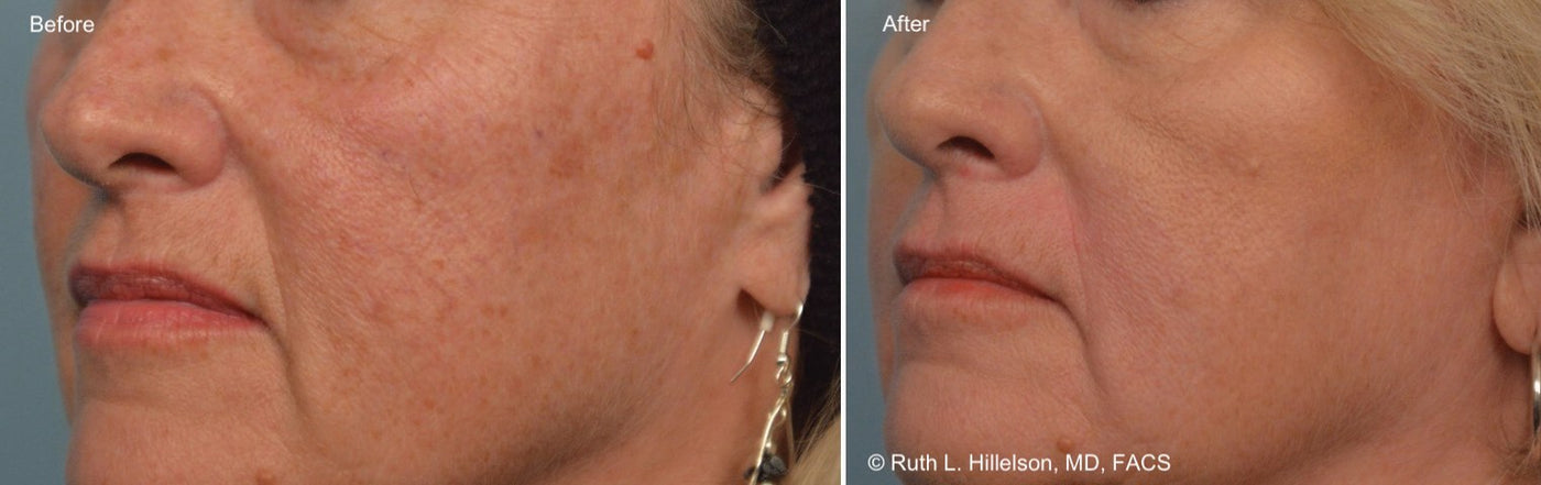Night Nutrient, before and after