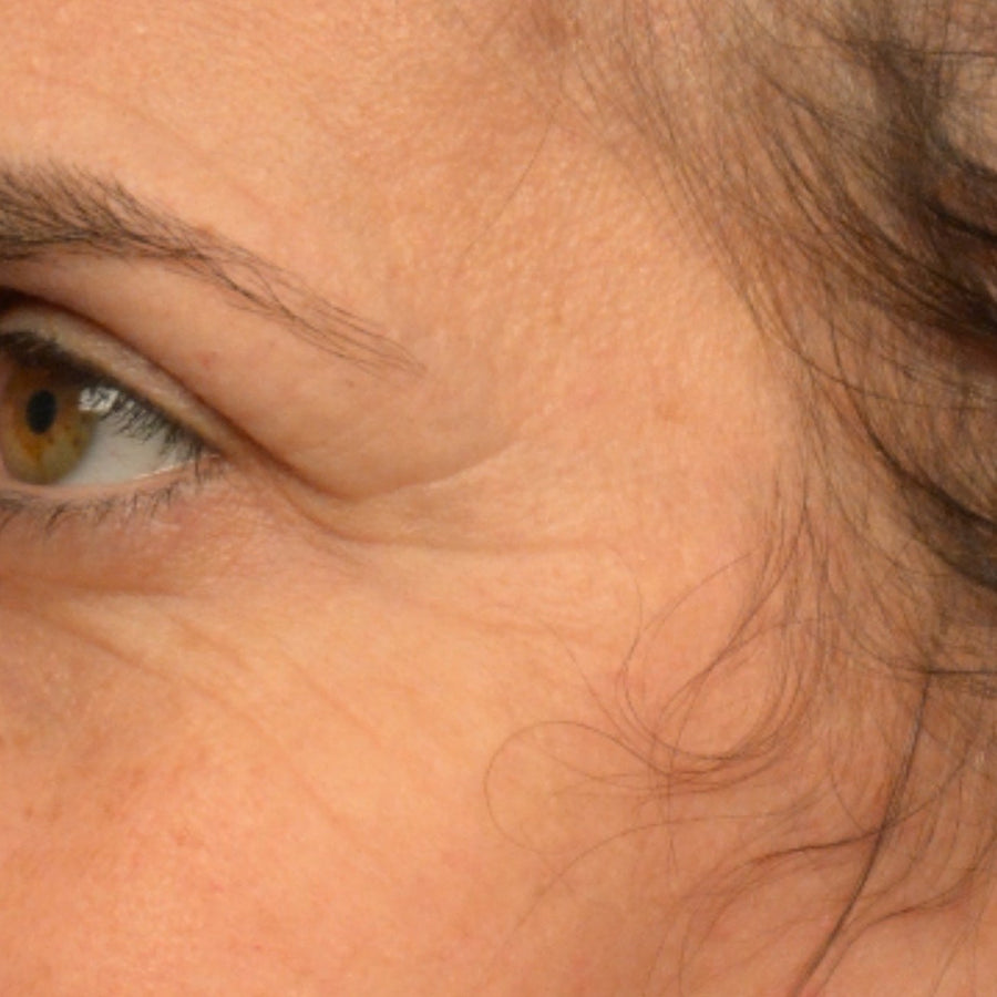Eye Love It®, before