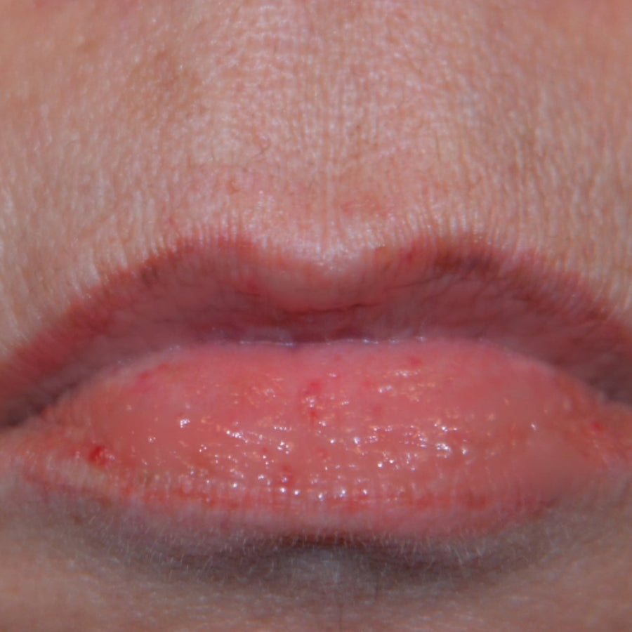 Kiss Lip Treatment, after